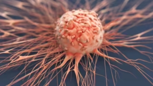 நாளுக்கு சுமார் 100 புதிய புற்றுநோயாளிகள்